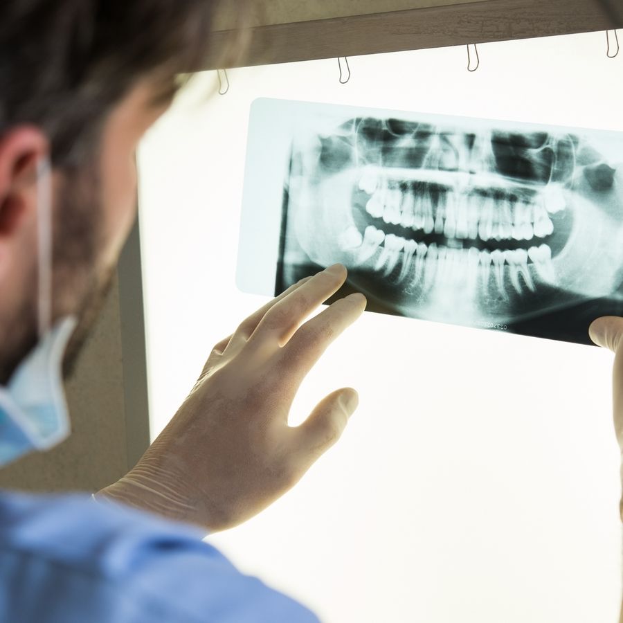implante dentario e suas tecnologias