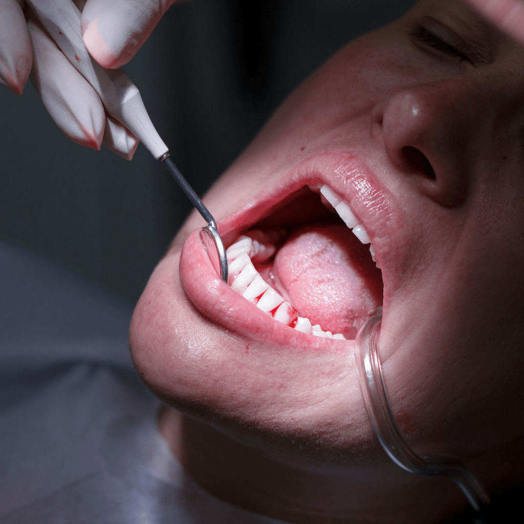 Periodontia: entenda melhor sobre essa área da odontologia