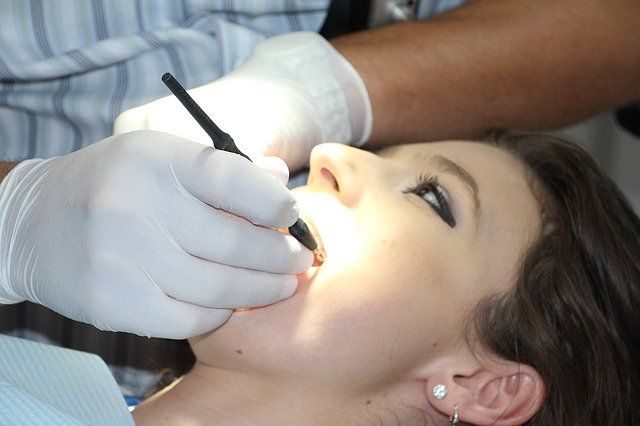 O que são implantes dentários? Indicações, duração e contraindicações