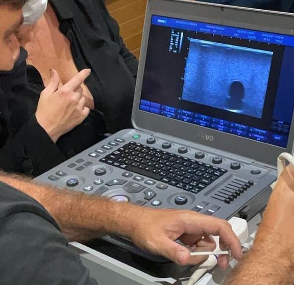 A importância da ultrassonografia na realização da Harmonização Facial